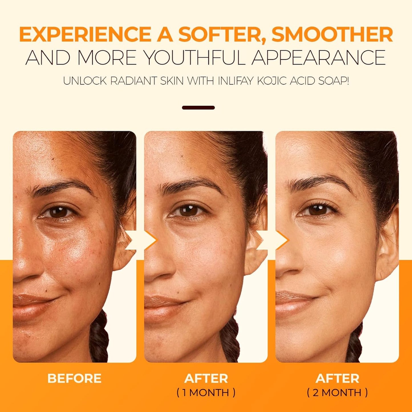 Kojic Acid Turmeric Soap: Dark Spot Remover for Face Body - Skin Cleansing Bar for Women with Hyperpigmentation - Home Travel Use in Summer