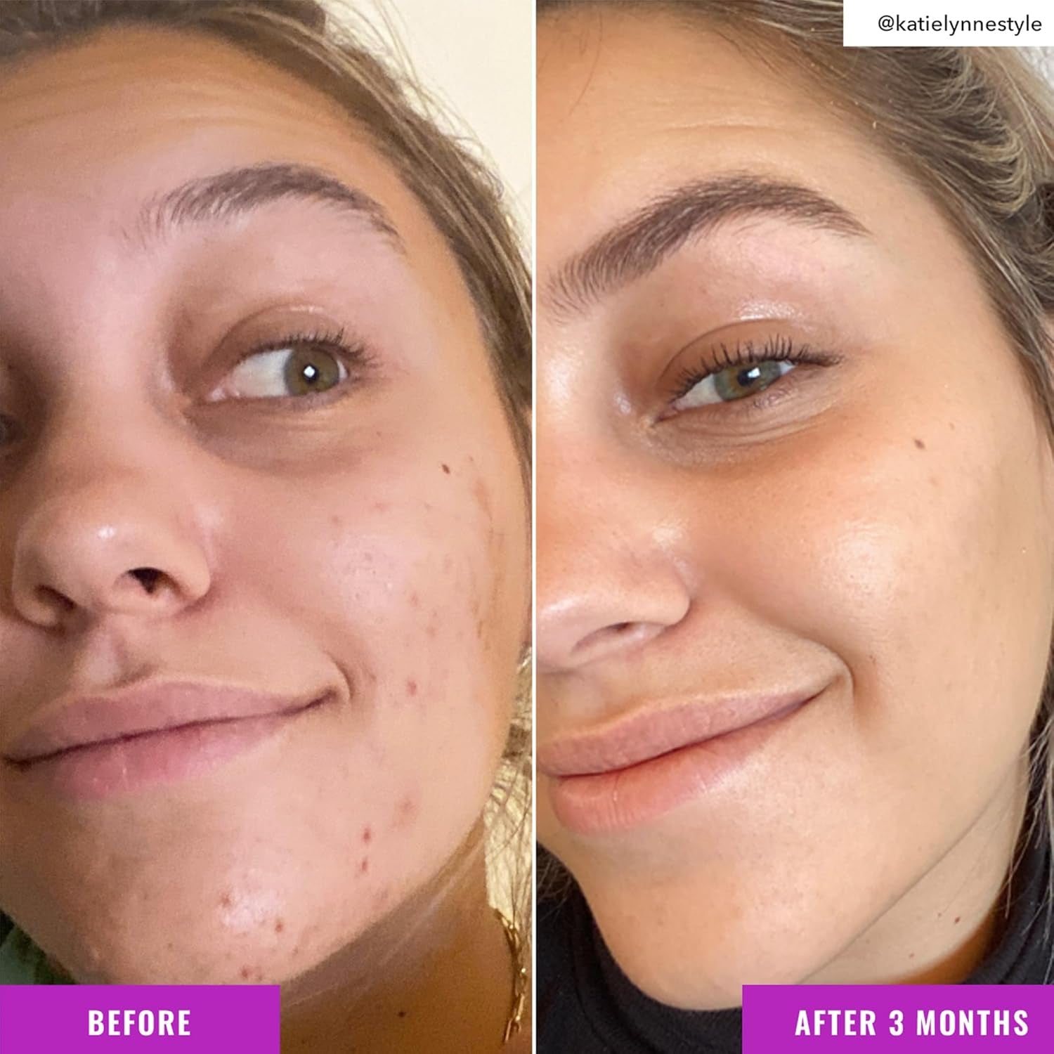 Niacinamide Brightening Toner - Toner for Face with Niacinamide and Arbutin for Skin Tone Balancing- Pore Minimizer, Skin Care for Face
